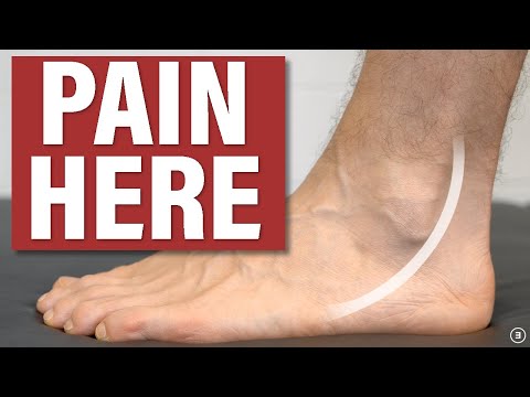 Peroneal Tendinopathy / Tendinitis: Causes & Treatment (Education | Strengthening | Stretching)