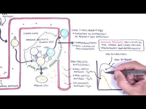 Epstein Barr Virus and Infectious Mononucleosis (pathophysiology, investigations and treatment)