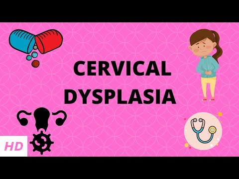 Cervical Dysplasia, Causes, Signs and Symptoms, Diagnosis and Treatment.