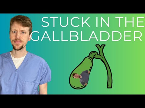 Gallbladder + Bile Duct Disease (explained by a GI doc)