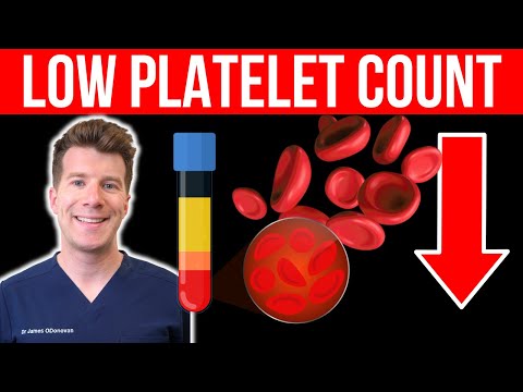 Doctor explains LOW PLATELET COUNT (Thrombocytopenia) | Causes, symptoms and more