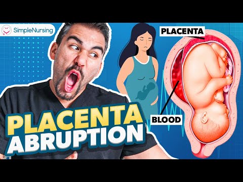 Placental Abruption Symptoms, Causes, Nursing Interventions | NCLEX Tips