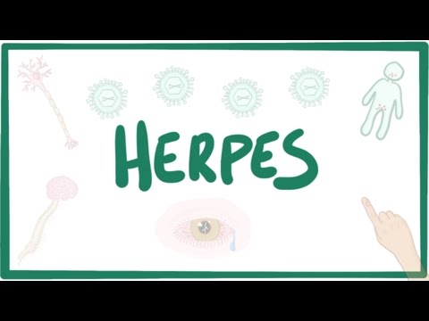 Herpes (oral & genital) - causes, symptoms, diagnosis, treatment, pathology