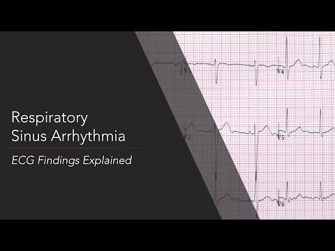 Respiratory Sinus Arrhythmia ECG