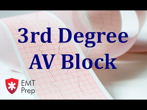 3rd Degree AV Block ECG - EMTprep.com