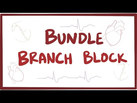 Bundle branch block - causes, symptoms, diagnosis, treatment, pathology