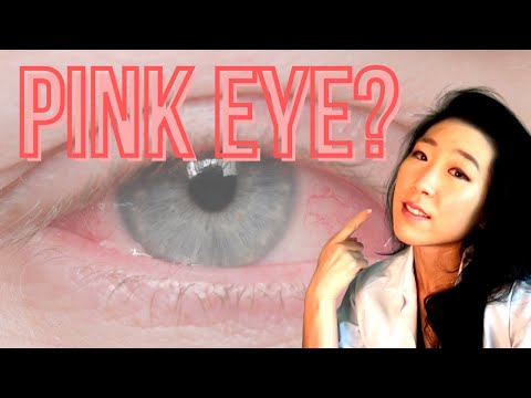 How Do I Know If I Have Pink Eye? | Common Causes Of Pink Eyes