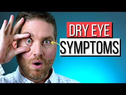 DRY EYES - The Surprising SYMPTOMS And Causes Of Dry Eye Syndrome