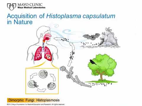 Dimorphic Fungi: Histoplasmosis [Hot Topic]