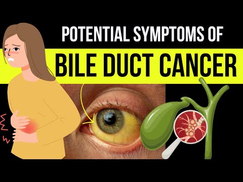 Doctor explains WARNING SYMPTOMS and SIGNS of BILE DUCT CANCER (aka Cholangiocarcinoma)