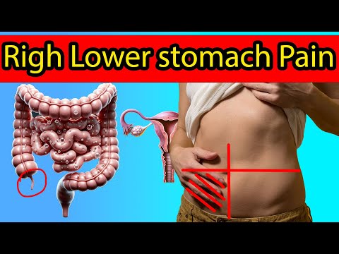 Right Lower Abdominal Pain,  7 Causes You Need to Know!