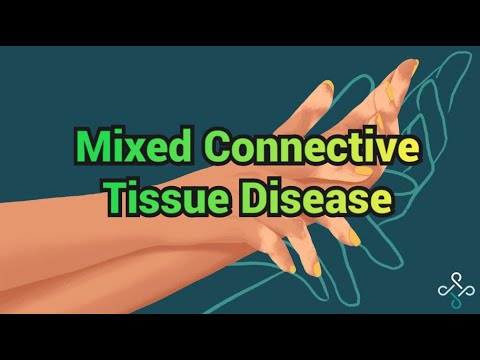 Mixed Connective Tissue Disease - CRASH! Medical Review Series