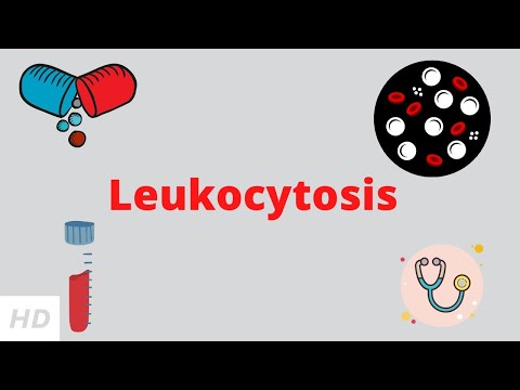 Leukocytosis, Causes, Signs and Symptoms, Diagnosis and Treatment.