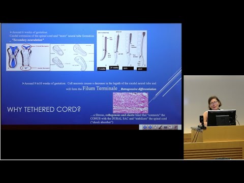 "The Occult Tethered Cord Syndrome" - Petra M  Klinge, MD, PhD