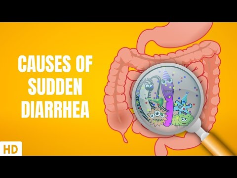 Causes of Sudden Diarrhea